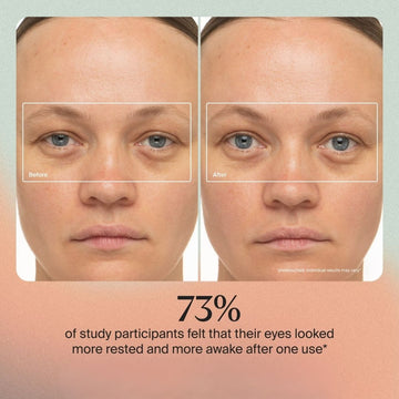 Nuvio Depuffing wand